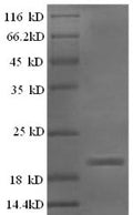 Recombinant Rat Ephrin-A5 (Efna5) – Figure 1 of 1