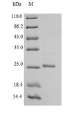 Recombinant Mouse Ephrin-B3 (Efnb3), partial – Figure 1 of 1