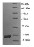 Recombinant Human Egl nine homolog 2 (EGLN2), partial – Figure 1 of 1