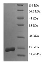 Recombinant Human Egl nine homolog 2 (EGLN2), partial – Figure 1 of 1