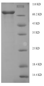Recombinant Human Interferon-induced, double-stranded RNA-activated protein kinase (EIF2AK2) – Figure 1 of 1