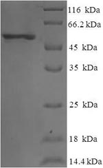 Recombinant Human Eukaryotic translation initiation factor 3 subunit G (EIF3G) – Figure 1 of 1