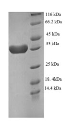 Recombinant Human Eukaryotic translation initiation factor 4E-binding protein 2 (EIF4EBP2) – Figure 1 of 1