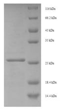 Recombinant Human Eukaryotic translation initiation factor 4E-binding protein 3 (EIF4EBP3) – Figure 1 of 1