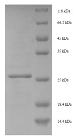 Recombinant Human Eukaryotic translation initiation factor 4E-binding protein 3 (EIF4EBP3) – Figure 1 of 1