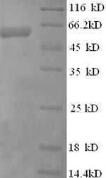 Recombinant Human Eukaryotic translation initiation factor 4 gamma 1 (EIF4G1), partial – Figure 1 of 1