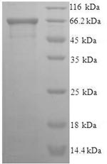 Recombinant Human Eukaryotic translation initiation factor 5 (EIF5) – Figure 1 of 1