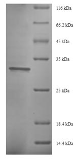 Recombinant Saccharomyces cerevisiae Eukaryotic translation initiation factor 5A-1 (HYP2) – Figure 1 of 1