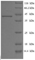 Recombinant Human Chymotrypsin-like elastase family member 3A (CELA3A) – Figure 1 of 1