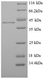 Recombinant Human ELAV-like protein 2 (ELAVL2), partial – Figure 1 of 1