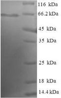 Recombinant Human Echinoderm microtubule-associated protein-like 2 (EML2), partial – Figure 1 of 1