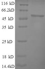 Recombinant Mouse Alpha-enolase (Eno1), partial – Figure 1 of 1