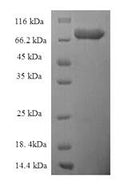 Recombinant Human Epoxide hydrolase 2 (EPHX2) – Figure 1 of 1