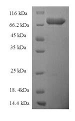 Recombinant Human Epoxide hydrolase 2 (EPHX2) – Figure 1 of 1