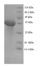 Recombinant Bovine Erythropoietin (EPO) – Figure 1 of 1