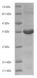 Recombinant Horse Erythropoietin (EPO) – Figure 1 of 1