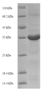 Recombinant Horse Erythropoietin (EPO) – Figure 1 of 1
