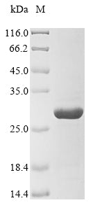 (Tris-Glycine gel) Discontinuous SDS-PAGE (reduced) with 5% enrichment gel and 15% separation gel.