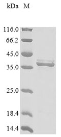 (Tris-Glycine gel) Discontinuous SDS-PAGE (reduced) with 5% enrichment gel and 15% separation gel.