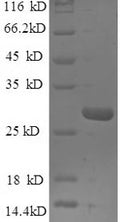 Recombinant Human Epiplakin (EPPK1), partial – Figure 1 of 1
