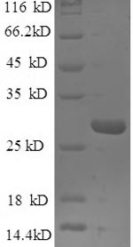 Recombinant Human Epiplakin (EPPK1), partial – Figure 1 of 1