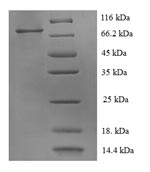 Recombinant Human Receptor tyrosine-protein kinase erbB-2 (ERBB2), partial – Figure 1 of 1