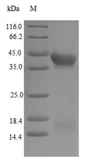 (Tris-Glycine gel) Discontinuous SDS-PAGE (reduced) with 5% enrichment gel and 15% separation gel.