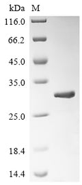 (Tris-Glycine gel) Discontinuous SDS-PAGE (reduced) with 5% enrichment gel and 15% separation gel.