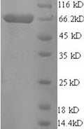 Recombinant Pig Electron transfer flavoprotein-ubiquinone oxidoreductase, mitochondrial (ETFDH) – Figure 1 of 1