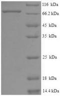 Recombinant Human Eyes absent homolog 2 (EYA2) – Figure 1 of 1