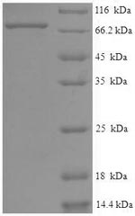 Recombinant Human Eyes absent homolog 2 (EYA2) – Figure 1 of 1