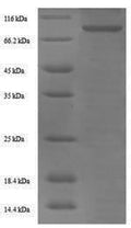 Recombinant Human Prothrombin (F2) – Figure 1 of 1