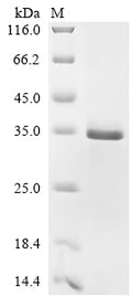 (Tris-Glycine gel) Discontinuous SDS-PAGE (reduced) with 5% enrichment gel and 15% separation gel.