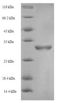 Recombinant Human Coagulation factor V (F5), partial – Figure 1 of 1