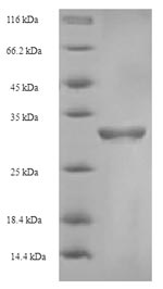 Recombinant Human Coagulation factor V (F5), partial – Figure 1 of 1