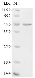 (Tris-Glycine gel) Discontinuous SDS-PAGE (reduced) with 5% enrichment gel and 15% separation gel.