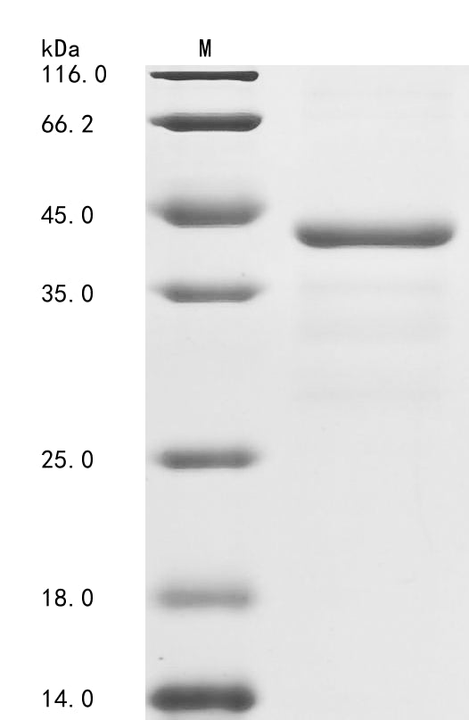(Tris-Glycine gel) Discontinuous SDS-PAGE (reduced) with 5% enrichment gel and 15% separation gel.