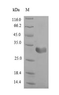 (Tris-Glycine gel) Discontinuous SDS-PAGE (reduced) with 5% enrichment gel and 15% separation gel.