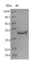 (Tris-Glycine gel) Discontinuous SDS-PAGE (reduced) with 5% enrichment gel and 15% separation gel.
