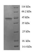 Recombinant Human Protein FAM110B (FAM110B) – Figure 1 of 1