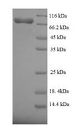 Recombinant Human Fanconi anemia group C protein (FANCC) – Figure 1 of 1