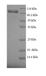 Recombinant Human Fanconi anemia group C protein (FANCC) – Figure 1 of 1