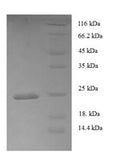 Recombinant Human Tumor necrosis factor ligand superfamily member 6 (FASLG), partial – Figure 1 of 1