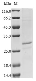 (Tris-Glycine gel) Discontinuous SDS-PAGE (reduced) with 5% enrichment gel and 15% separation gel.