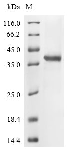 (Tris-Glycine gel) Discontinuous SDS-PAGE (reduced) with 5% enrichment gel and 15% separation gel.