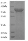 Recombinant Human F-box/LRR-repeat protein 18 (FBXL18), partial – Figure 1 of 1