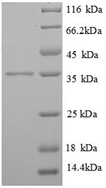 Recombinant Human High affinity immunoglobulin epsilon receptor subunit gamma (FCER1G) – Figure 1 of 1