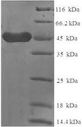 Recombinant Human Low affinity immunoglobulin epsilon Fc receptor (FCER2), partial – Figure 1 of 1
