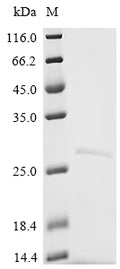 (Tris-Glycine gel) Discontinuous SDS-PAGE (reduced) with 5% enrichment gel and 15% separation gel.