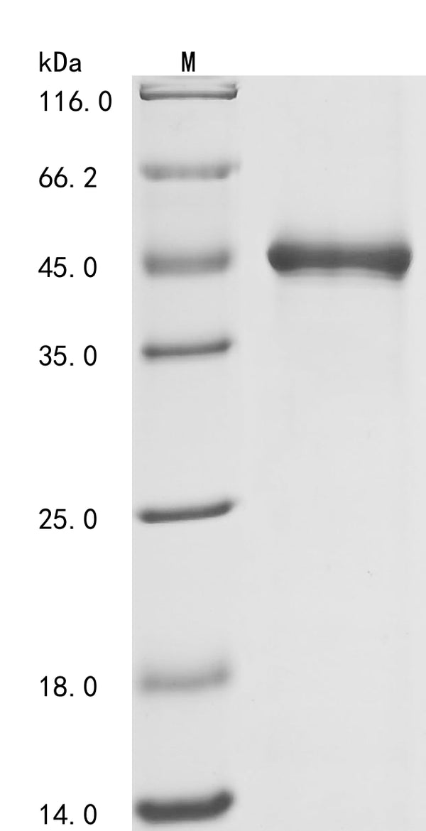 (Tris-Glycine gel) Discontinuous SDS-PAGE (reduced) with 5% enrichment gel and 15% separation gel.